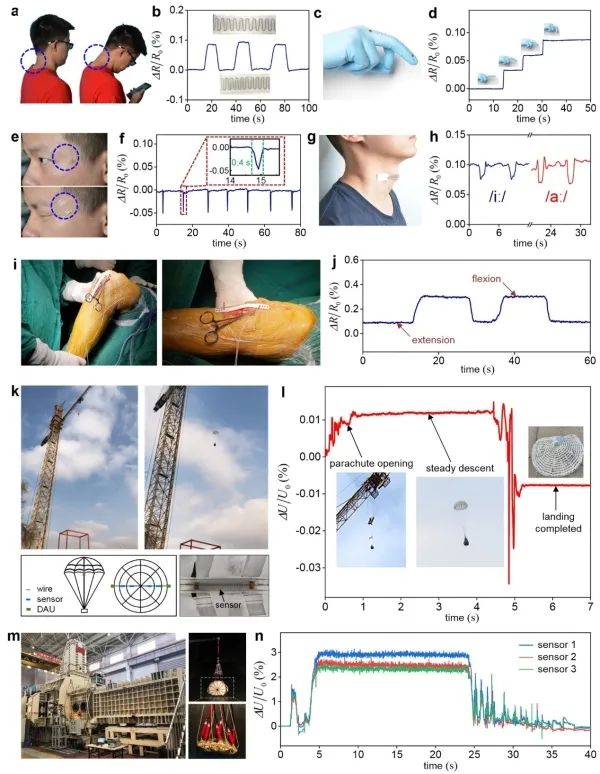人体活动监测、医疗手术和航天设备中的典型应用 人体活动监测、医疗手术和航天设备中的典型应用